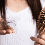 Mãos femininas segurando grande quantidade de fios caídos e escova de cabelo devido ao eflúvio telógeno associado ao mounjaro e queda de cabelo.